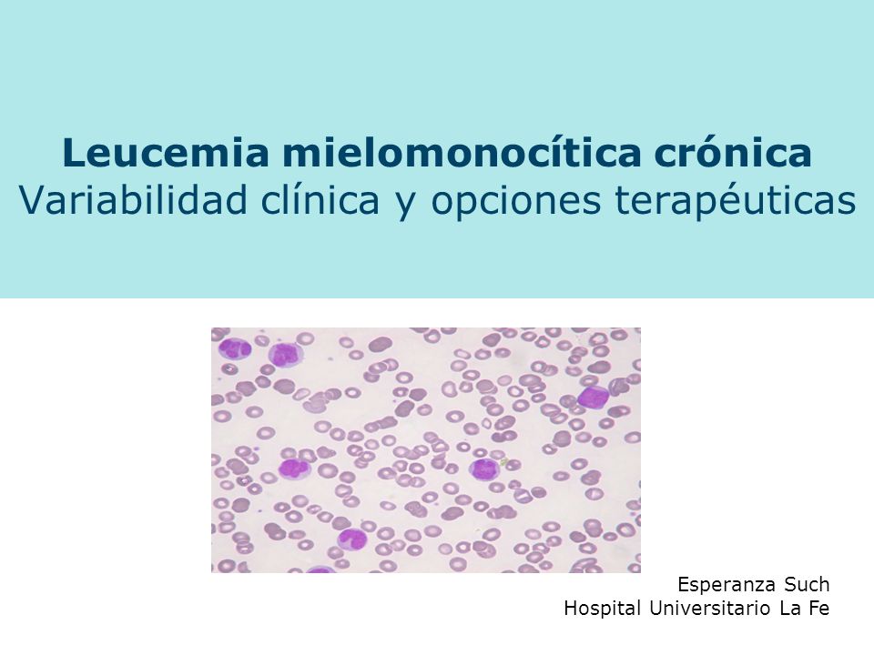 leucemia mielomonocitica cronica